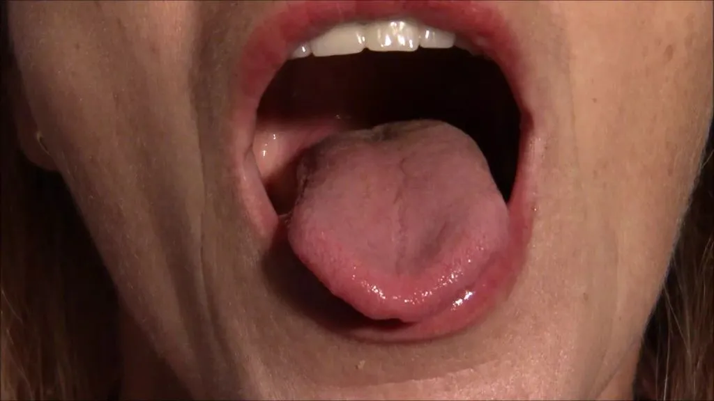 thumbnail foto nr. 5 von Für Peter, Mundfotze